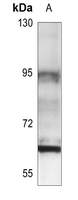 1 - Anti-Estrogen Receptor beta Antibody AP60282