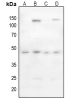 1 - Anti-CD142 (Phospho-S290) Antibody AP60283