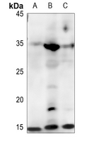 1 - Anti-FABP4 Antibody AP60284