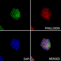 3 - Anti-FGF23 Antibody AP60285