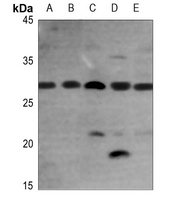 1 - Anti-FGF23 Antibody AP60285