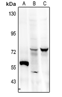 1 - Anti-FRS2 (Phospho-Y436) Antibody AP60287