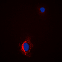 3 - Anti-GAB1 (Phospho-Y627) Antibody AP60288