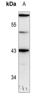 1 - Anti-GATA1 (Phospho-S310) Antibody AP60290