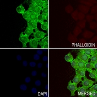3 - Anti-GIT2 Antibody AP60294