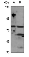 1 - Anti-GIT2 Antibody AP60294