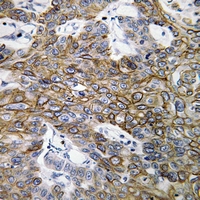 19 - Anti-Connexin 46 Antibody AP60295
