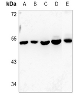 1 - Anti-Connexin 46 Antibody AP60295