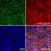 3 - Anti-GNAT1 Antibody AP60296