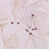 19 - Anti-GNAT1 Antibody AP60296