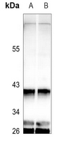 1 - Anti-GNAT1 Antibody AP60296