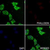 3 - Anti-DHAPAT Antibody AP60298