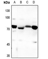 1 - Anti-DHAPAT Antibody AP60298