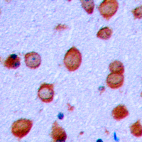 19 - Anti-GLUR2 (Phospho-S880) Antibody AP60299