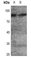 1 - Anti-GLUR2 (Phospho-S880) Antibody AP60299
