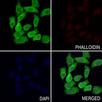 3 - Anti-Beta-glucuronidase Antibody AP60302