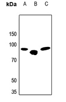 1 - Anti-Beta-glucuronidase Antibody AP60302