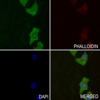 3 - Anti-GYS1 (Phospho-S645) Antibody AP60303