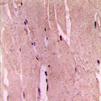 19 - Anti-GYS1 (Phospho-S645) Antibody AP60303