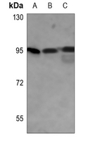 1 - Anti-GYS1 (Phospho-S645) Antibody AP60303