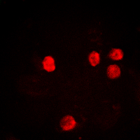 3 - Anti-Histone H2B (Acetyl-K12) Antibody AP60304