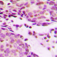 19 - Anti-Histone H2B (Acetyl-K12) Antibody AP60304