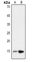 1 - Anti-Histone H2B (Acetyl-K12) Antibody AP60304