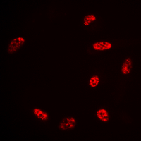 3 - Anti-Histone H2B (Acetyl-K15) Antibody AP60305