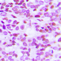 19 - Anti-Histone H2B (Acetyl-K15) Antibody AP60305