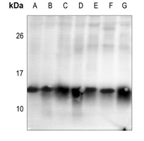1 - Anti-Histone H2B (Acetyl-K15) Antibody AP60305