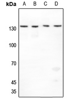 1 - Anti-Histone Deacetylase 4 Antibody AP60306