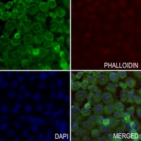 3 - Anti-Histone Deacetylase 8 Antibody AP60307