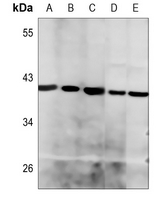 1 - Anti-Histone Deacetylase 8 Antibody AP60307