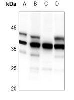 1 - Anti-HDGFRP3 Antibody AP60308