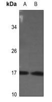 1 - Anti-Histone H3 (Phospho-S28) Antibody AP60309