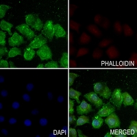 3 - Anti-Histone H3 (Acetyl-K122) Antibody AP60310