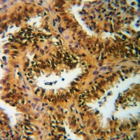 19 - Anti-Histone H3 (Acetyl-K122) Antibody AP60310