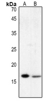 1 - Anti-Histone H3 (Acetyl-K122) Antibody AP60310
