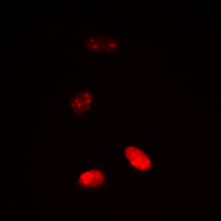 3 - Anti-Histone H3 (Acetyl-K18) Antibody AP60311