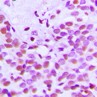 19 - Anti-Histone H3 (Acetyl-K18) Antibody AP60311