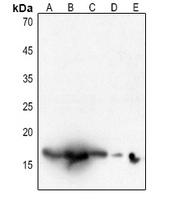 1 - Anti-Histone H3 (Acetyl-K18) Antibody AP60311