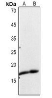 1 - Anti-Histone H3 (Acetyl-K23) Antibody AP60312