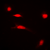 3 - Anti-Histone H3 (Acetyl-K27) Antibody AP60313