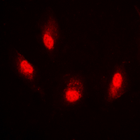 3 - Anti-Histone H4 (Acetyl-K8) Antibody AP60314