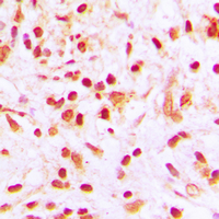 19 - Anti-Histone H4 (Acetyl-K8) Antibody AP60314