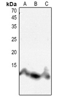 1 - Anti-Histone H4 (Acetyl-K8) Antibody AP60314