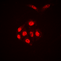 3 - Anti-Histone H4 (Acetyl-K16) Antibody AP60315