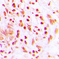 19 - Anti-Histone H4 (Acetyl-K16) Antibody AP60315