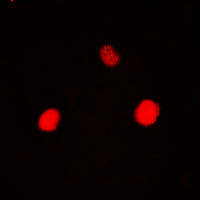 3 - Anti-Hexokinase 1 Antibody AP60316