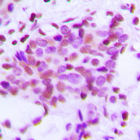 19 - Anti-Hexokinase 1 Antibody AP60316